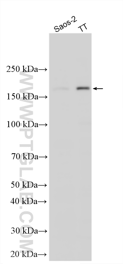 WB analysis using 31666-1-AP