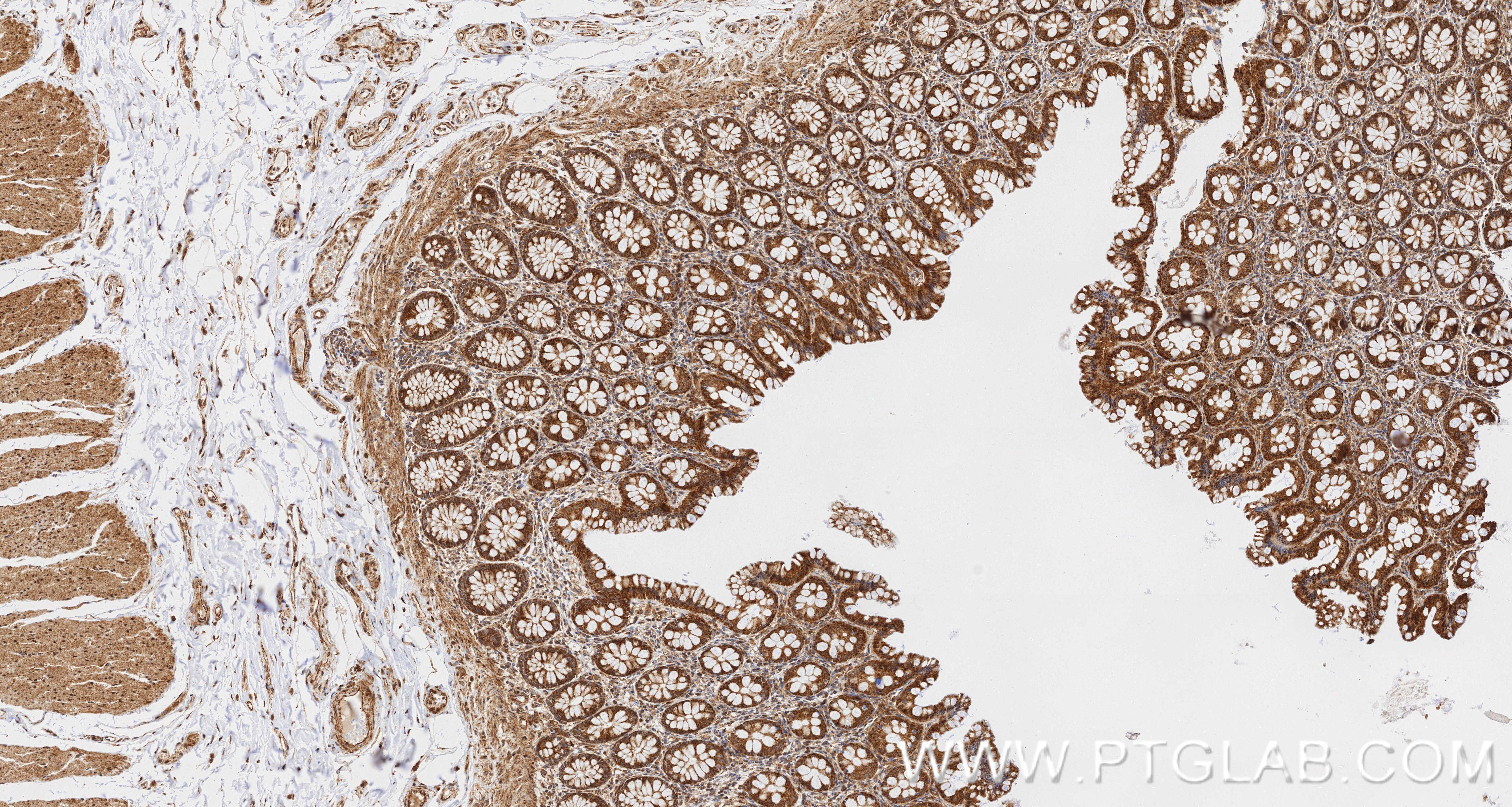 IHC staining of human colon using 86260-4-RR