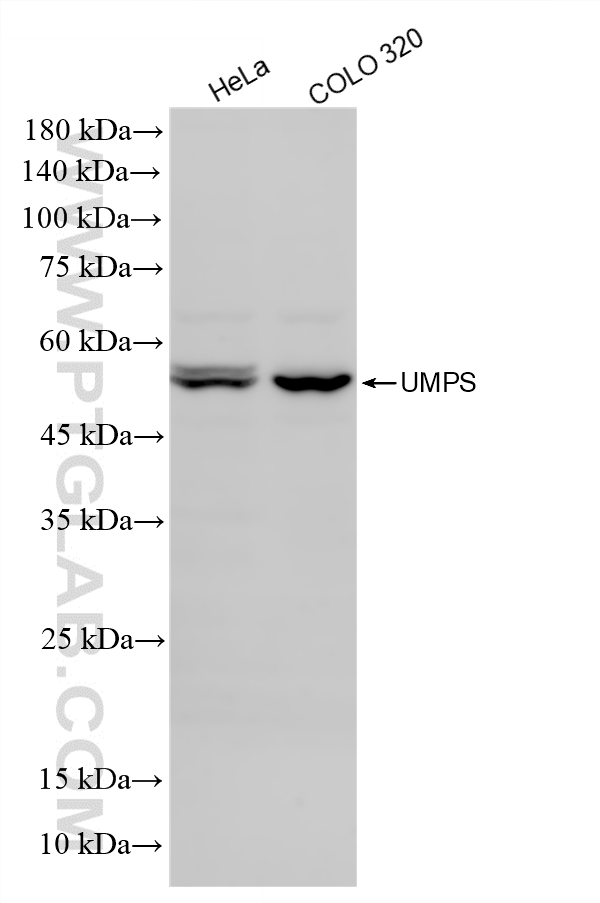 Various lysates were subjected to SDS PAGE followed by western blot with 86260-4-RR (UMPS antibody) at dilution of 1:1000 incubated at room temperature for 1.5 hours. WB analysis using 86260-4-RR