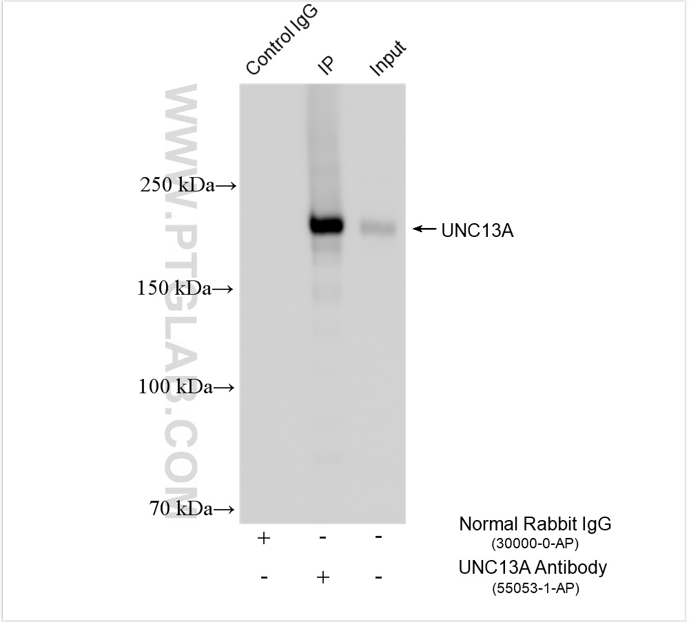IP result of anti-UNC13A (IP:55053-1-AP, 4ug; Detection:55053-1-AP 1:10000) with mouse brain tissue lysate 1720 ug. IP experiment of mouse brain using 55053-1-AP