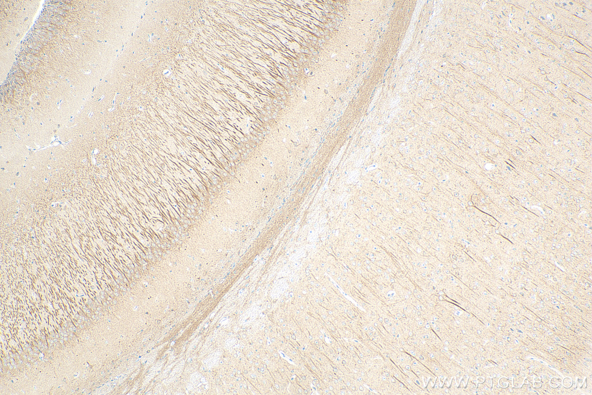 IHC staining of mouse brain using 83000-5-RR