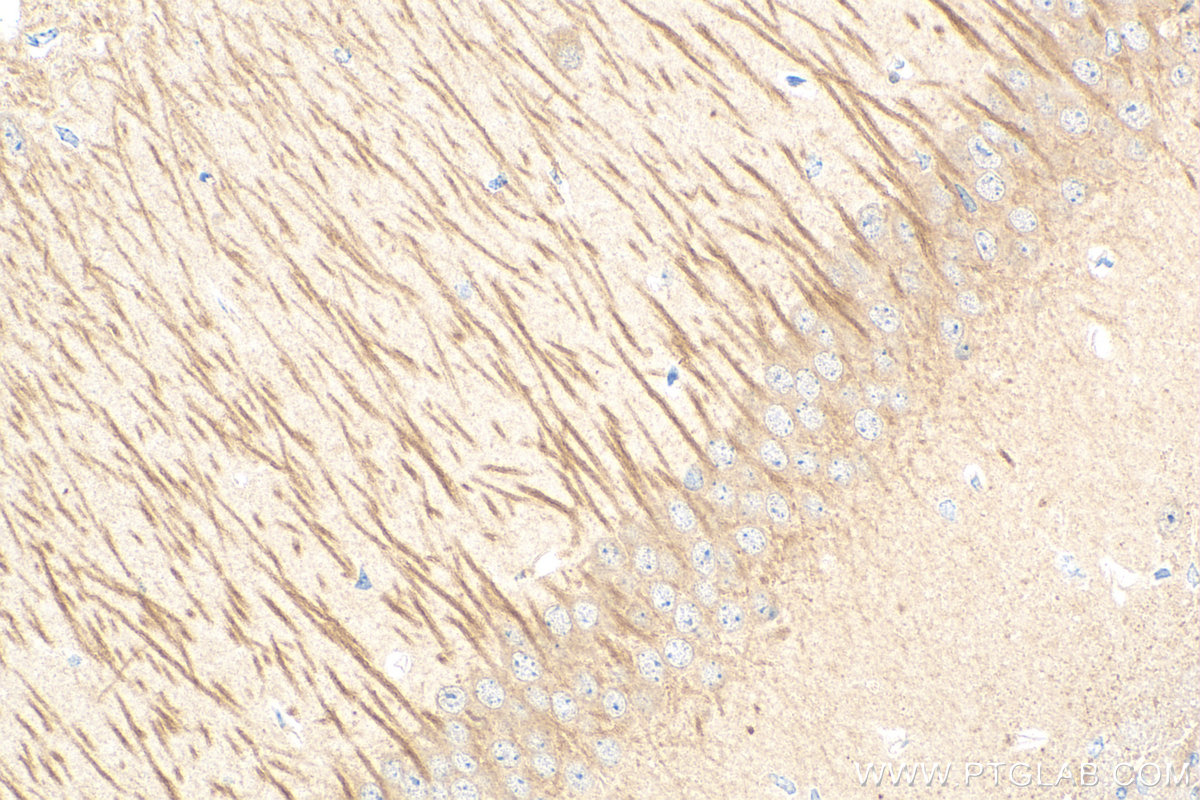 IHC staining of mouse brain using 83000-5-RR
