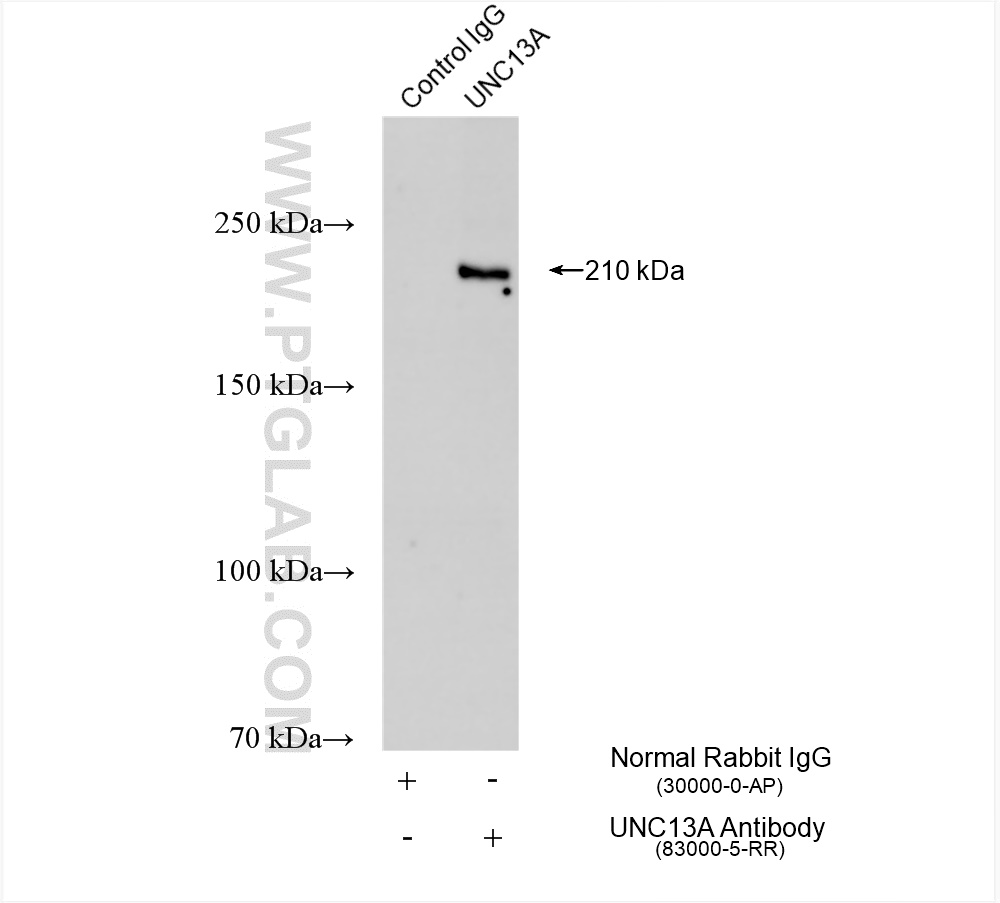 IP experiment of mouse brain using 83000-5-RR