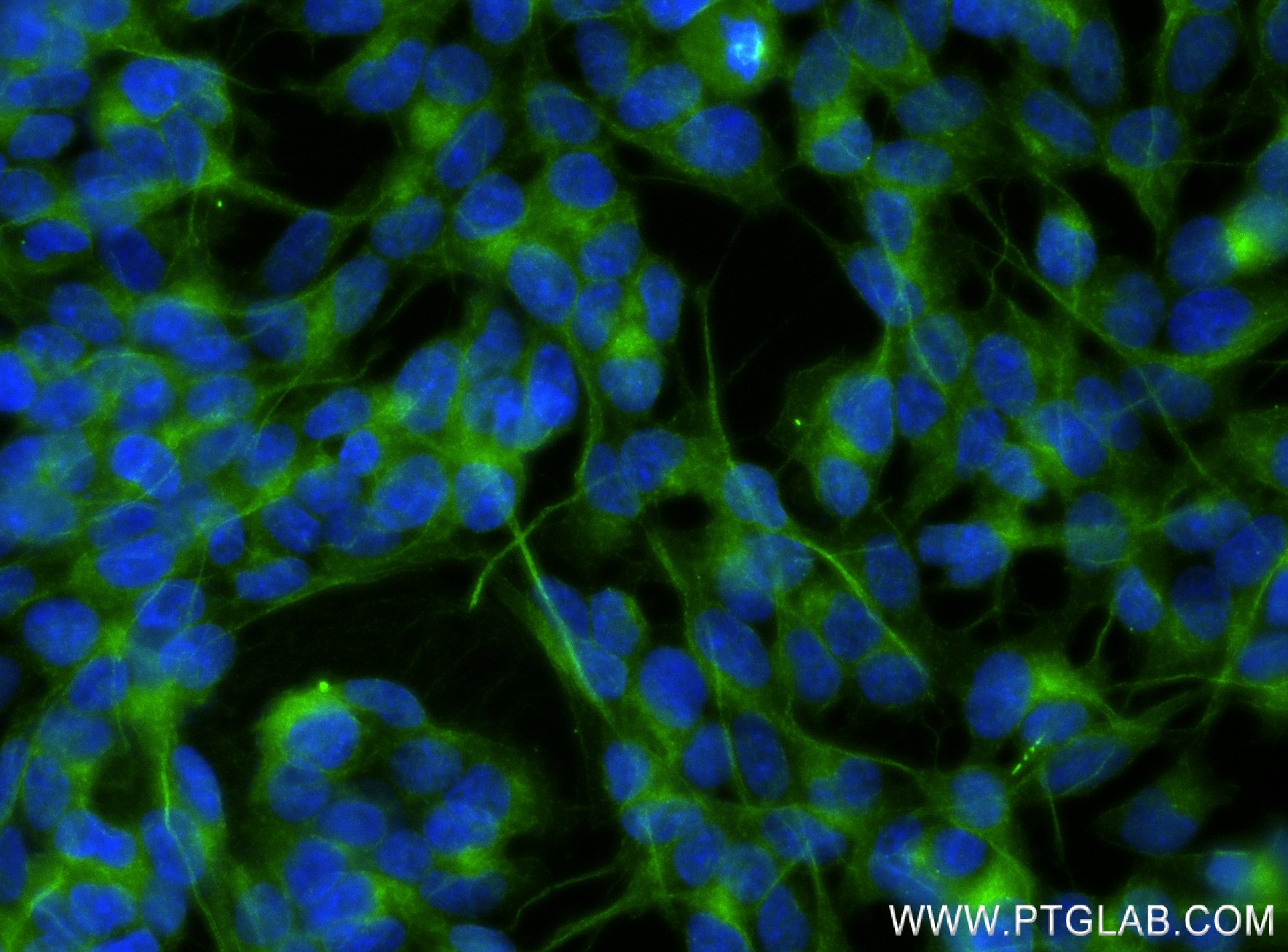 IF Staining of SH-SY5Y using 83000-6-RR