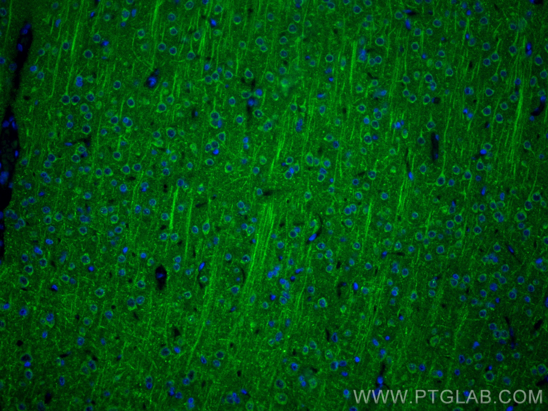 IF Staining of rat brain using 83000-6-RR