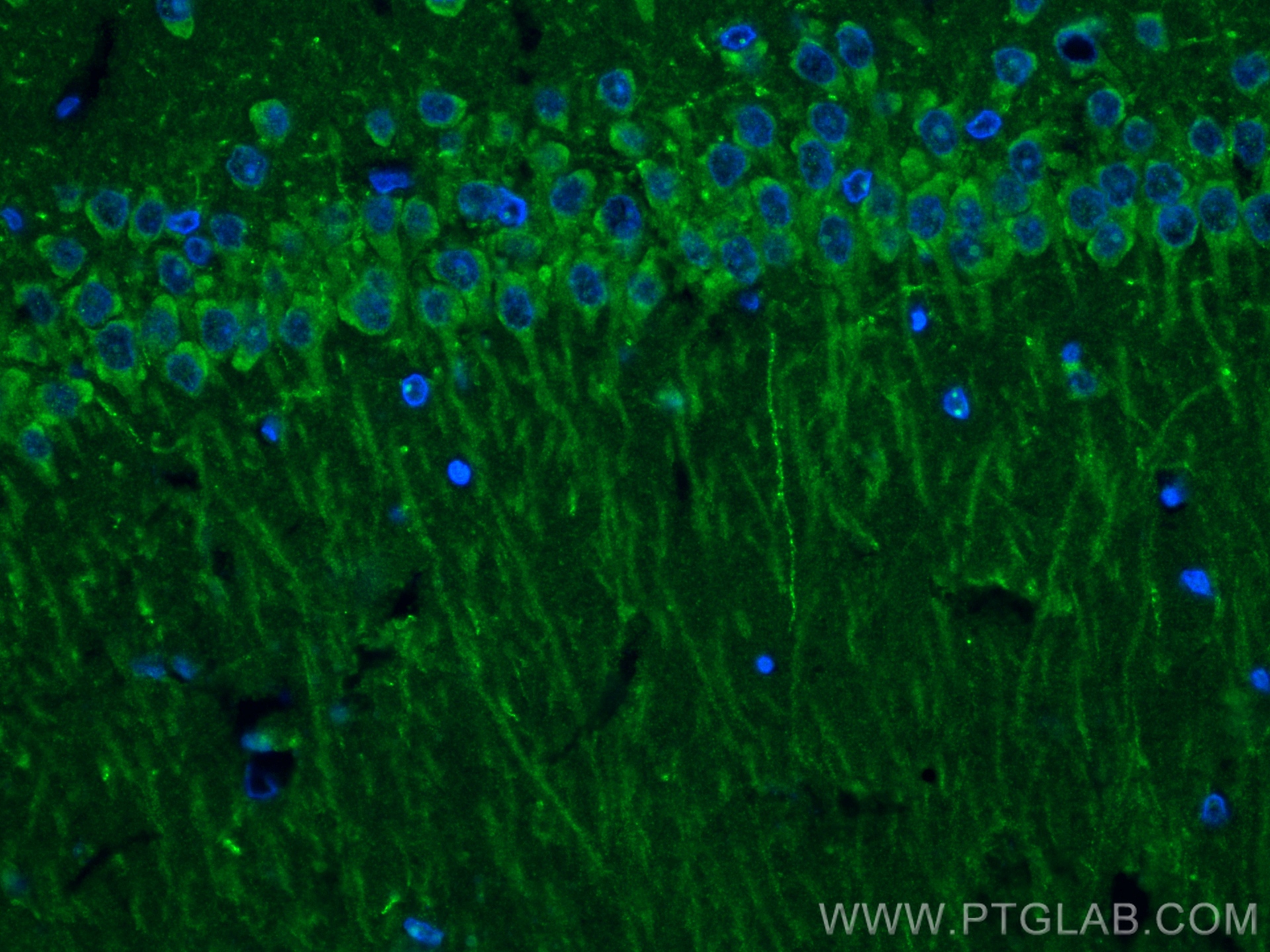 IF Staining of rat brain using 83000-6-RR