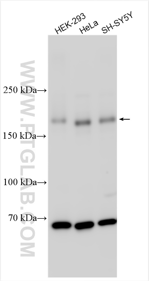 WB analysis using 21839-1-AP