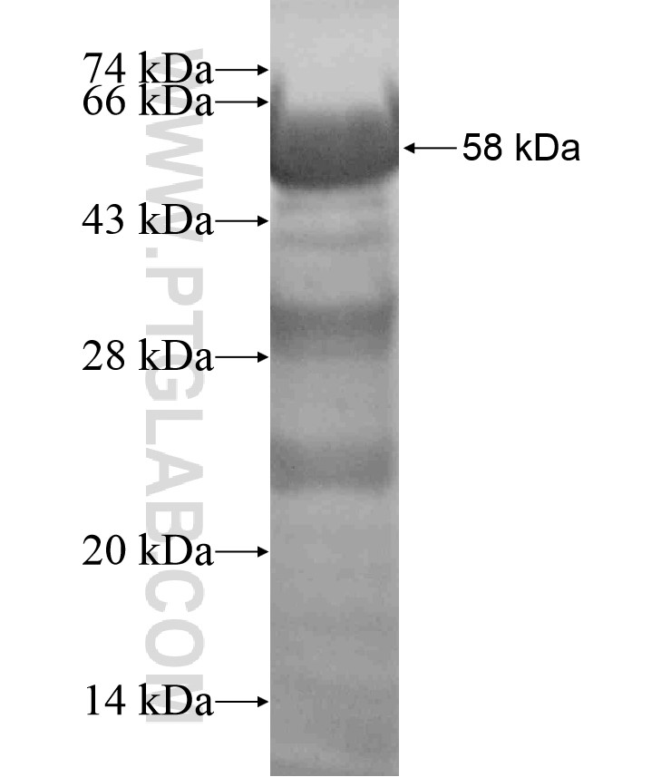 UNC13B fusion protein Ag17450 SDS-PAGE UNC13B fusion protein Ag17450 SDS-PAGE