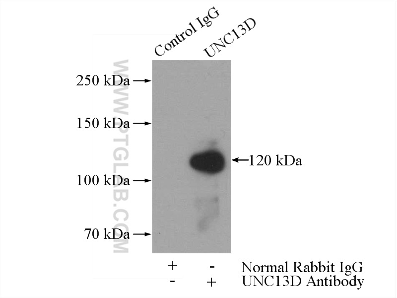 IP experiment of Jurkat using 16905-1-AP