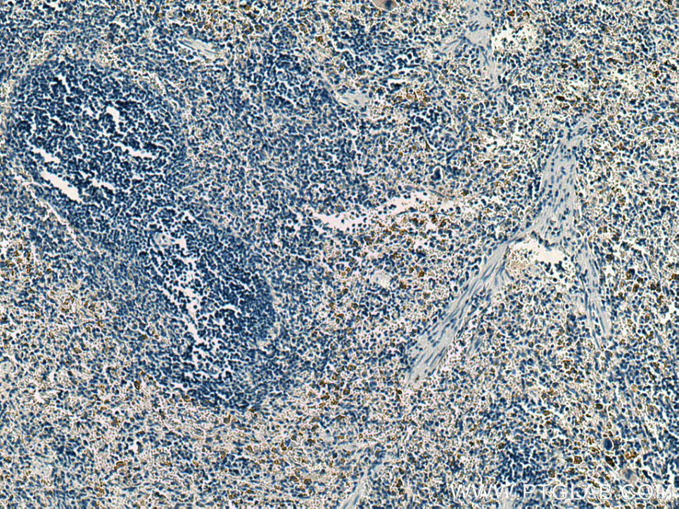 IHC staining of rat spleen using 67193-1-Ig