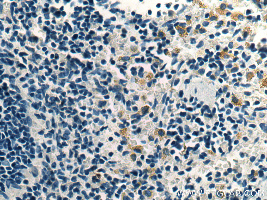 IHC staining of rat spleen using 67193-1-Ig