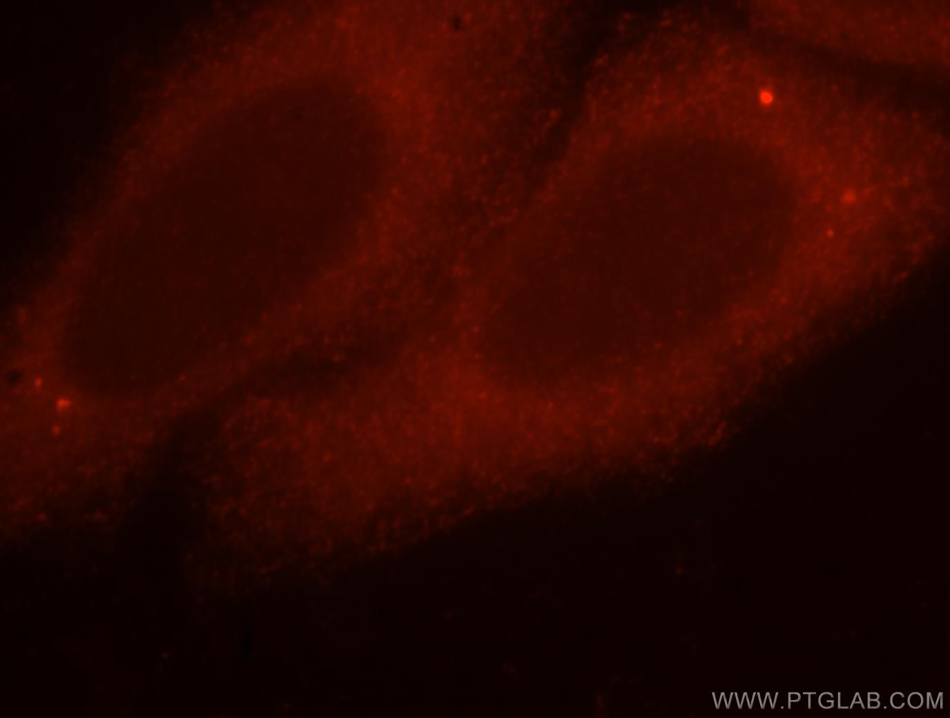 IF Staining of HepG2 using 15479-1-AP