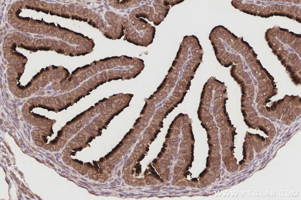 IHC staining of mouse ovary using 19564-1-AP IHC staining of mouse ovary using 19564-1-AP