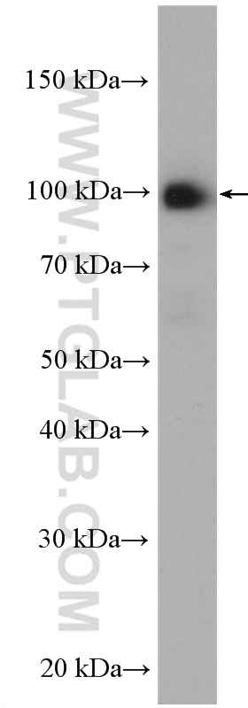 WB analysis of K-562 using 19564-1-AP