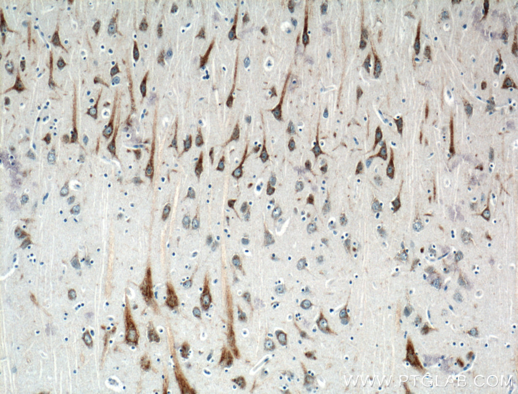 IHC staining of human brain using 22068-1-AP