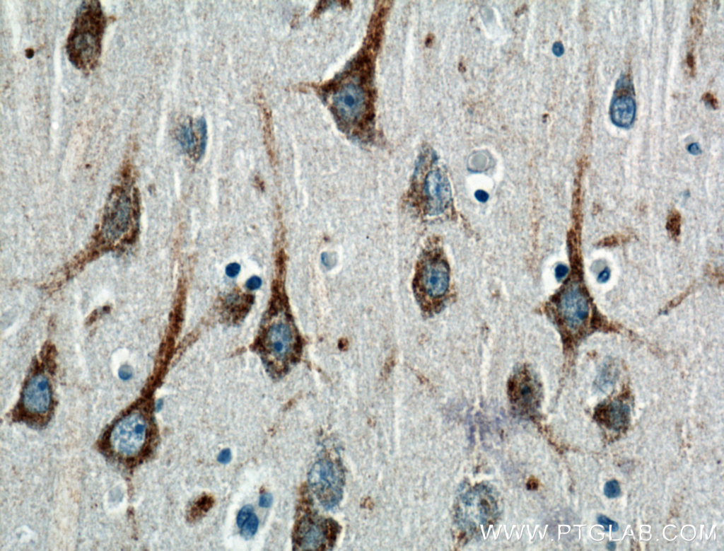 IHC staining of human brain using 22068-1-AP