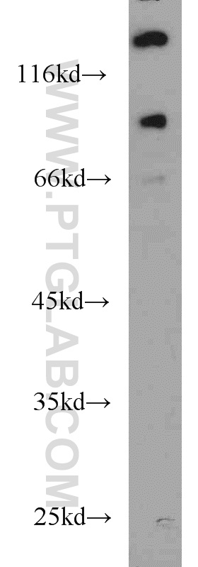 WB analysis of HeLa using 22068-1-AP