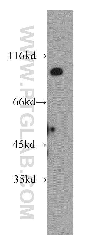 WB analysis of mouse brain using 20239-1-AP