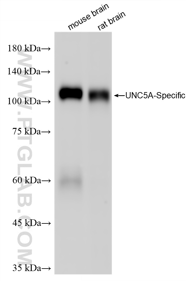 Various lysates were subjected to SDS PAGE followed by western blot with 86582-1-RR (UNC5A-Specific antibody) at dilution of 1:2000 incubated at room temperature for 1.5 hours. WB analysis using 86582-1-RR
