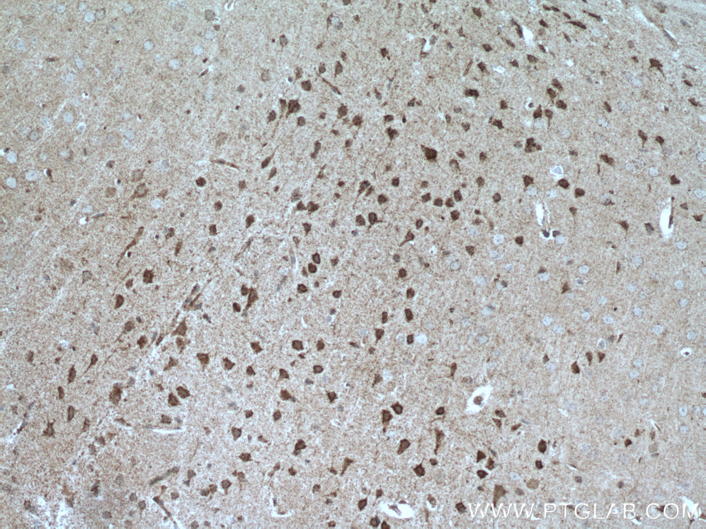 IHC staining of mouse brain using 20240-1-AP