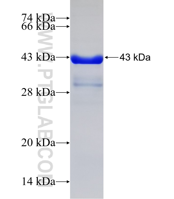 UNC5D fusion protein Ag31973 SDS-PAGE