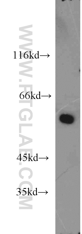 WB analysis of mouse kidney using 20241-1-AP