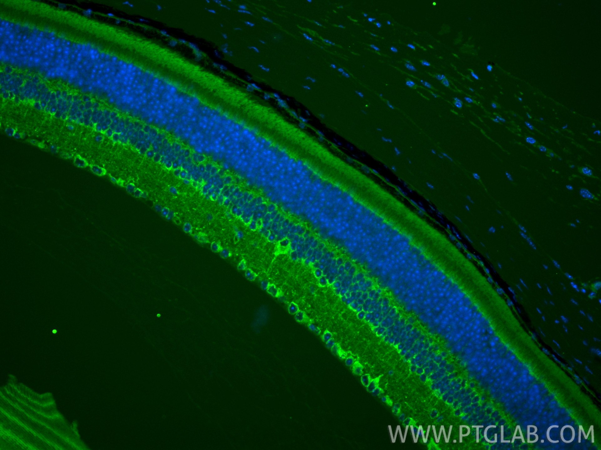 IF Staining of mouse eye using 84642-1-RR IF Staining of mouse eye using 84642-1-RR