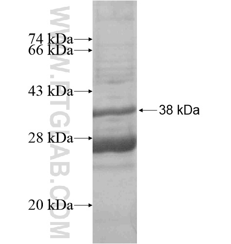 UNC93A fusion protein Ag15831 SDS-PAGE UNC93A fusion protein Ag15831 SDS-PAGE