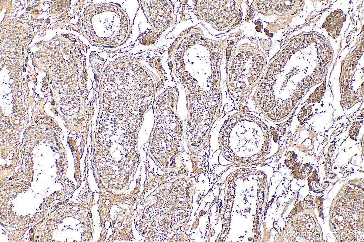 IHC staining of human testis using 12394-1-AP