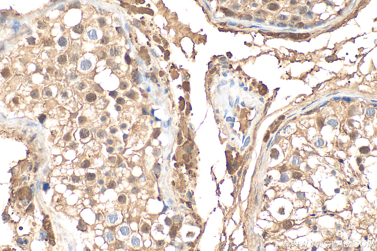 IHC staining of human testis using 12394-1-AP