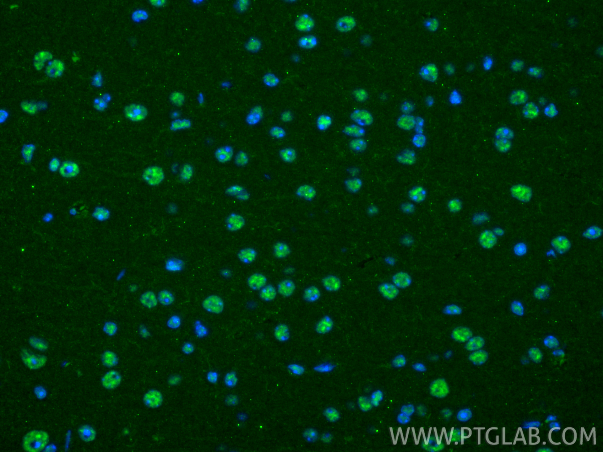 IF Staining of mouse brain using 67490-1-Ig