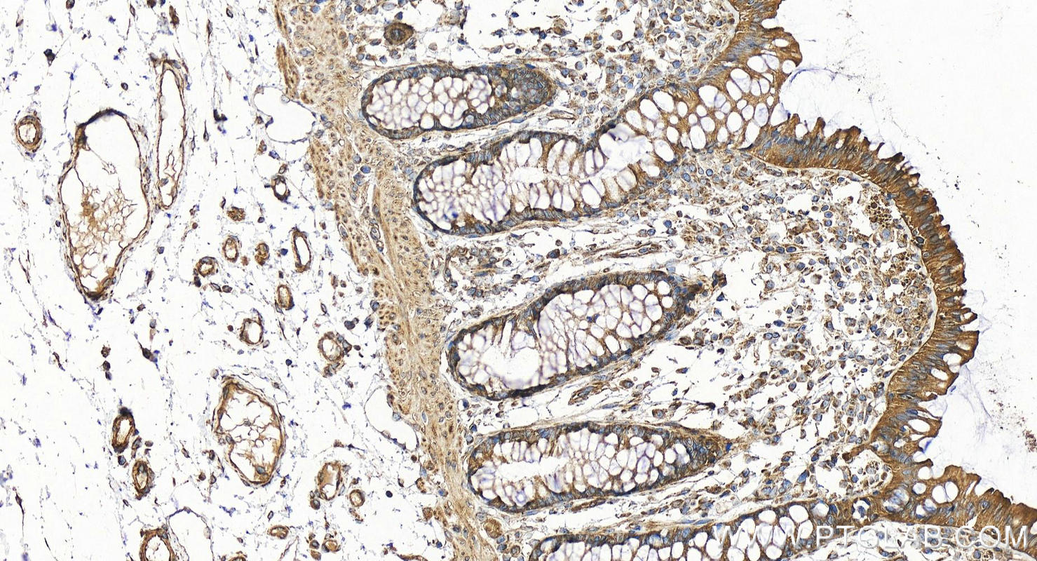 IHC staining of human colon using 31574-1-AP