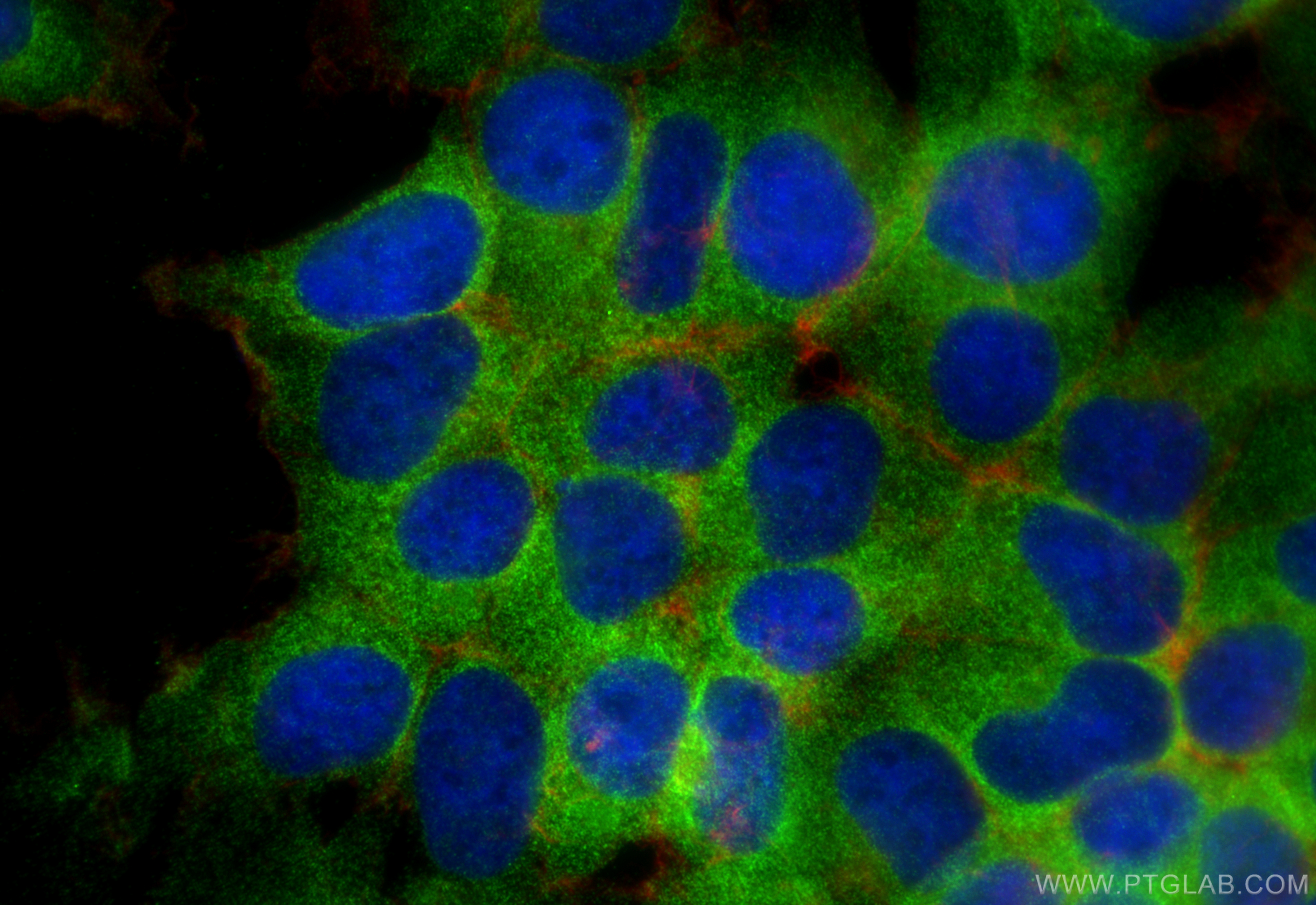 IF Staining of HEK-293 using 31574-1-AP