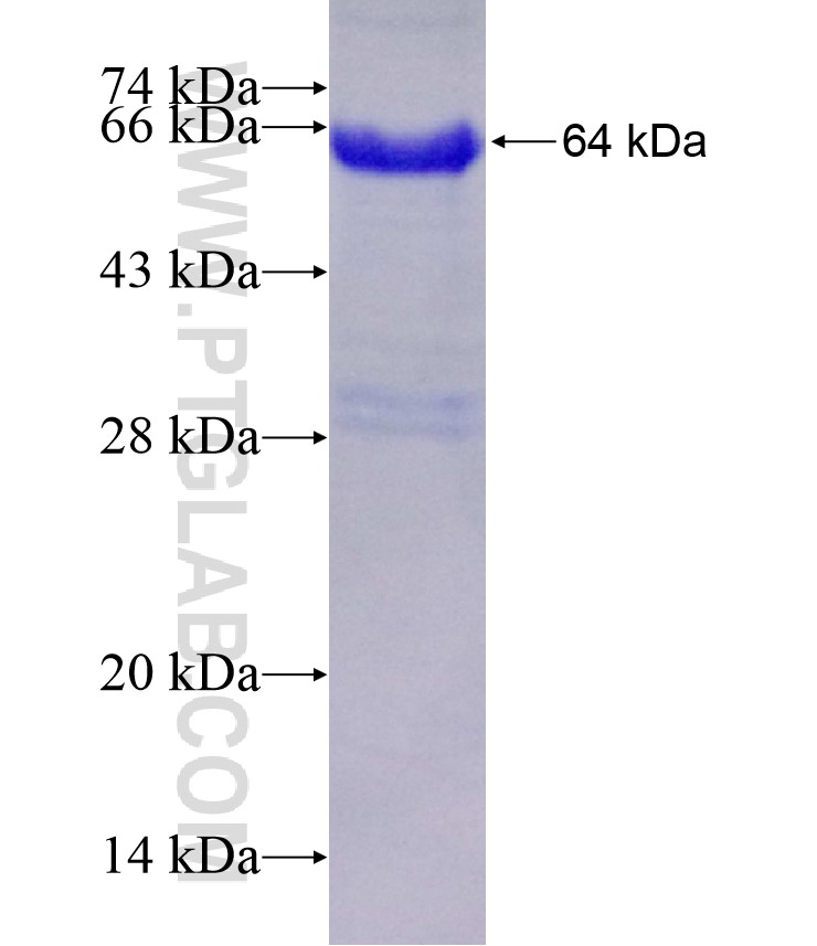UNR; CSDE1 fusion protein Ag4173 SDS-PAGE