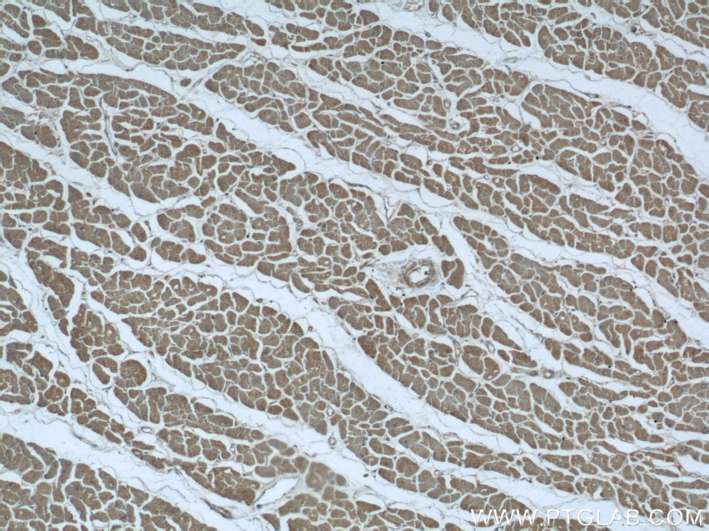 IHC staining of human heart using 24603-1-AP