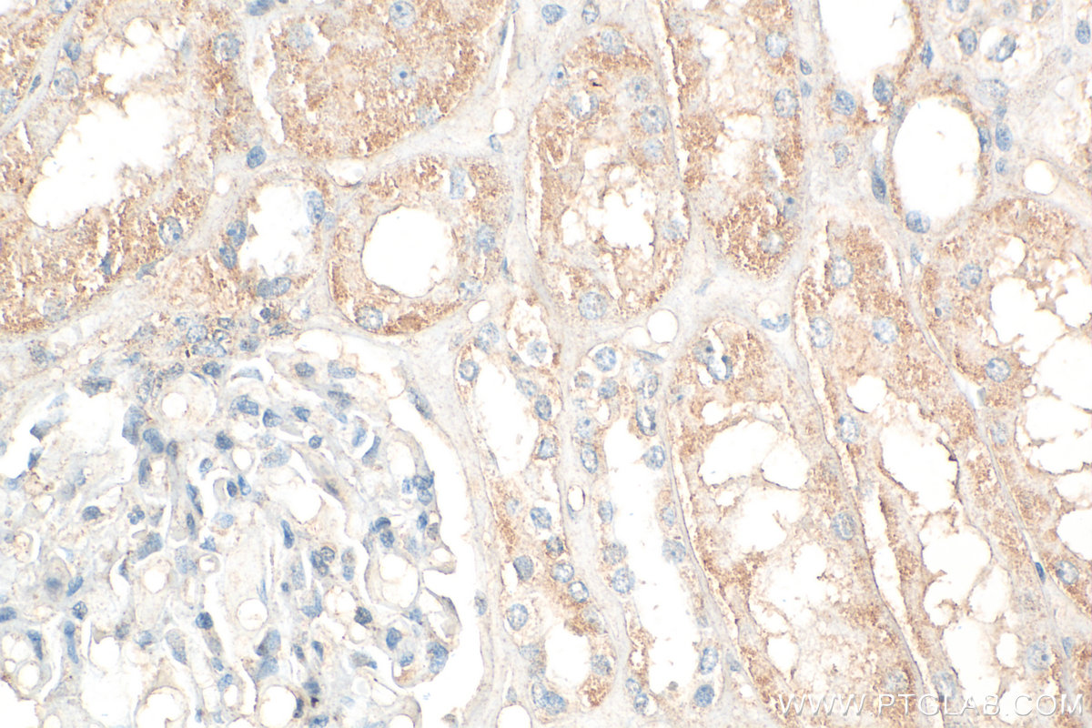 Immunohistochemical analysis of paraffin-embedded human kidney tissue slide using 23379-1-AP (UPF1 antibody) at dilution of 1:200 (under 40x lens). Heat mediated antigen retrieval with Tris-EDTA buffer (pH 9.0). IHC staining of human kidney using 23379-1-AP