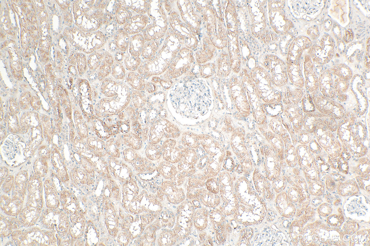 Immunohistochemical analysis of paraffin-embedded human kidney tissue slide using 23379-1-AP (UPF1 antibody) at dilution of 1:200 (under 10x lens). Heat mediated antigen retrieval with Tris-EDTA buffer (pH 9.0). IHC staining of human kidney using 23379-1-AP