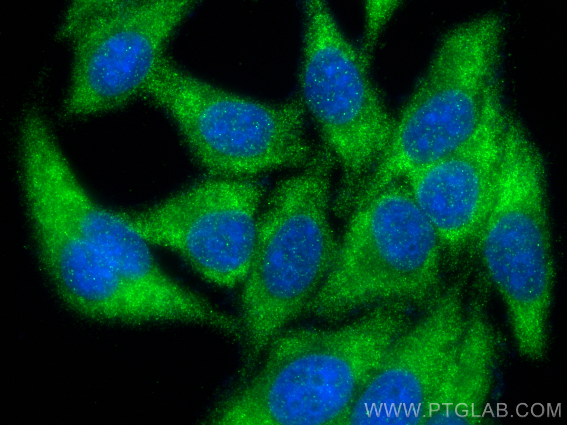 IF Staining of HepG2 using 28384-1-AP (same clone as 28384-1-PBS)