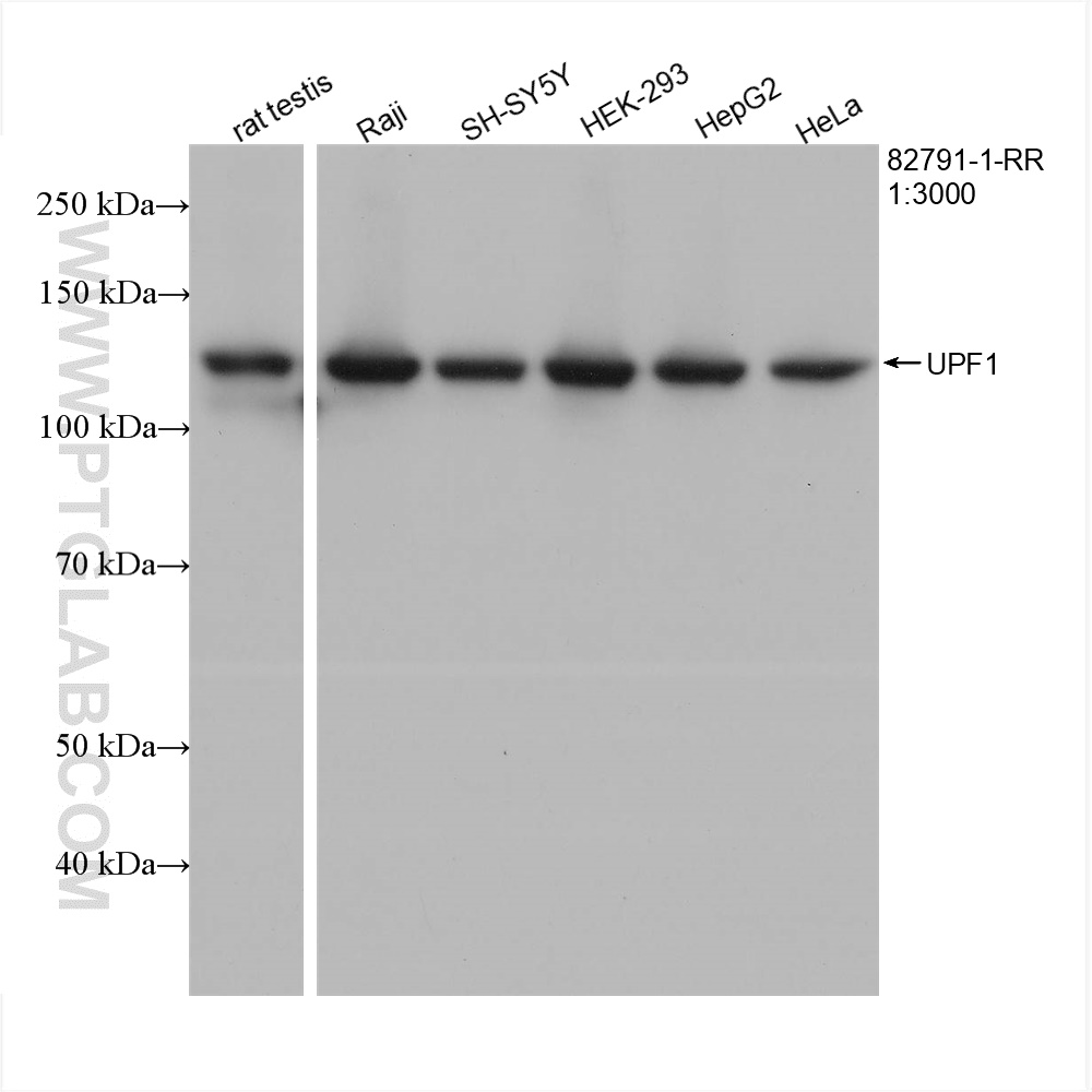 WB analysis using 82791-1-RR (same clone as 82791-1-PBS)