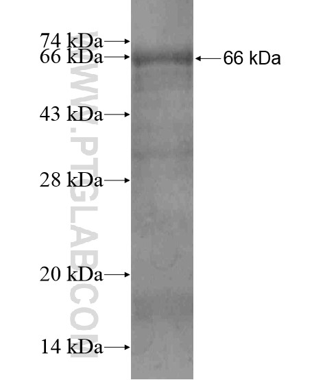 UPF2 fusion protein Ag19766 SDS-PAGE UPF2 fusion protein Ag19766 SDS-PAGE