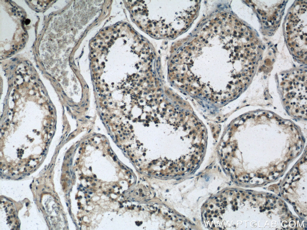 IHC staining of human testis using 23301-1-AP