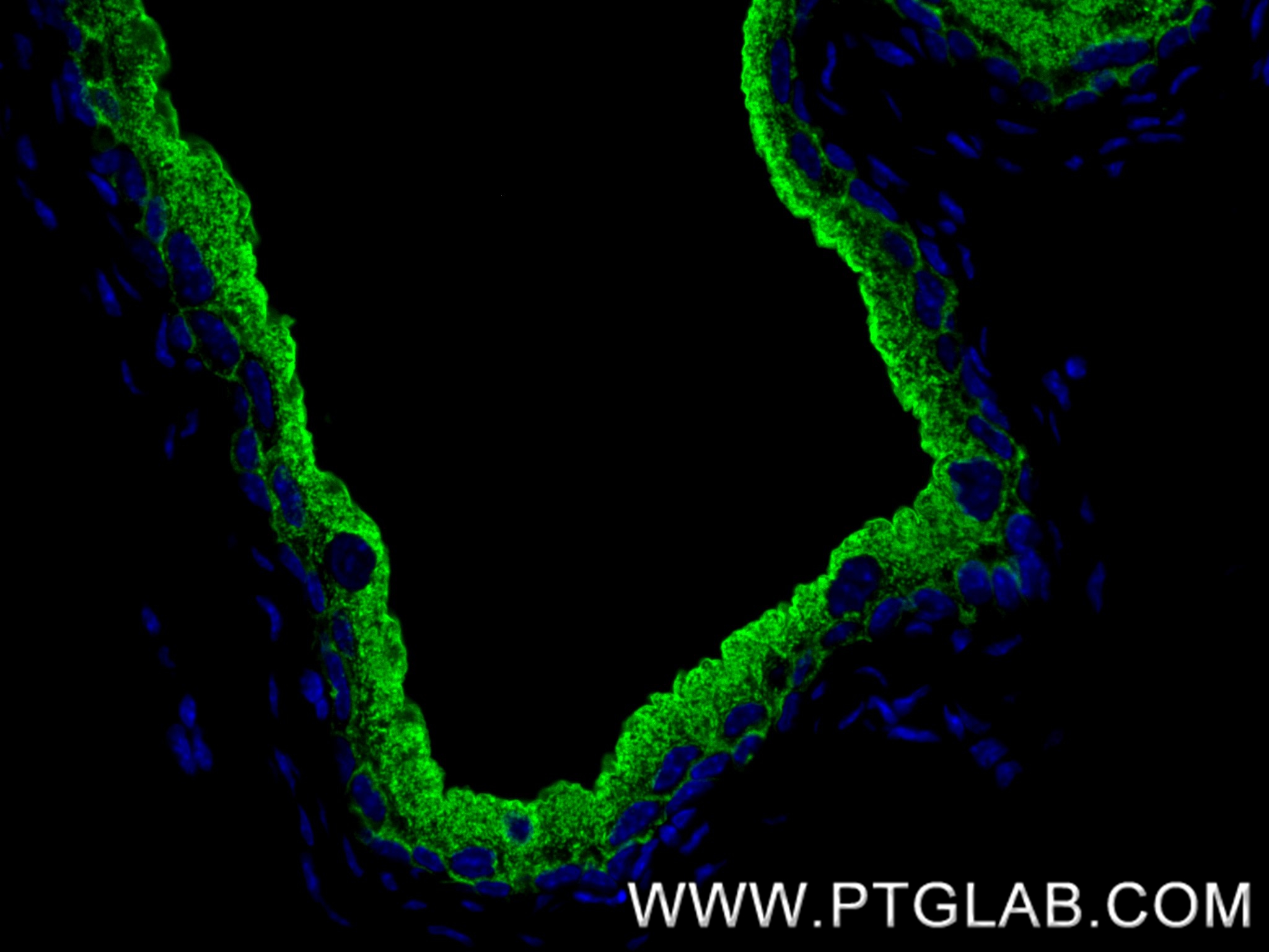 IF Staining of mouse bladder using 86799-1-RR