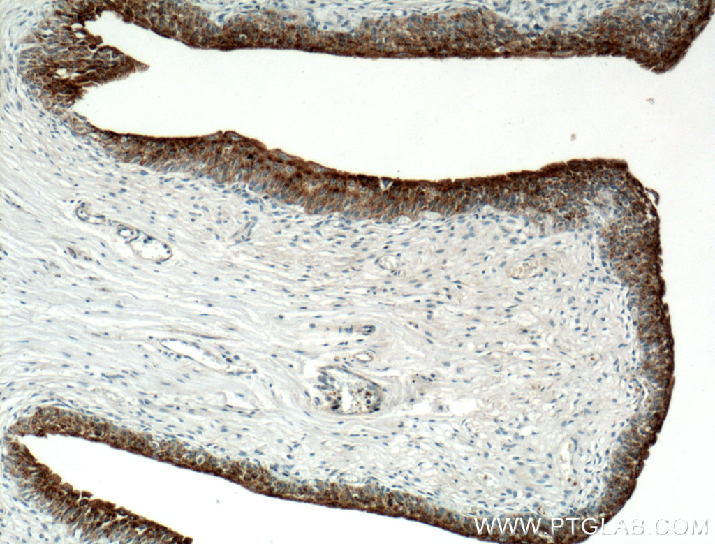 IHC staining of human bladder using 21149-1-AP