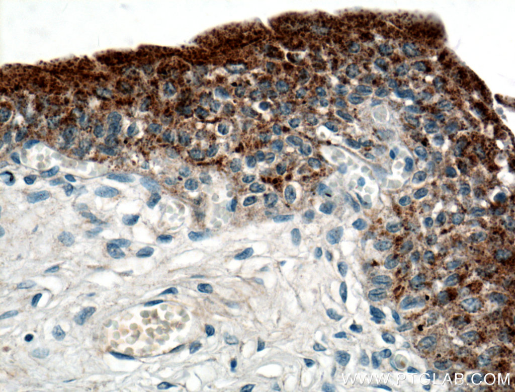 IHC staining of human bladder using 21149-1-AP