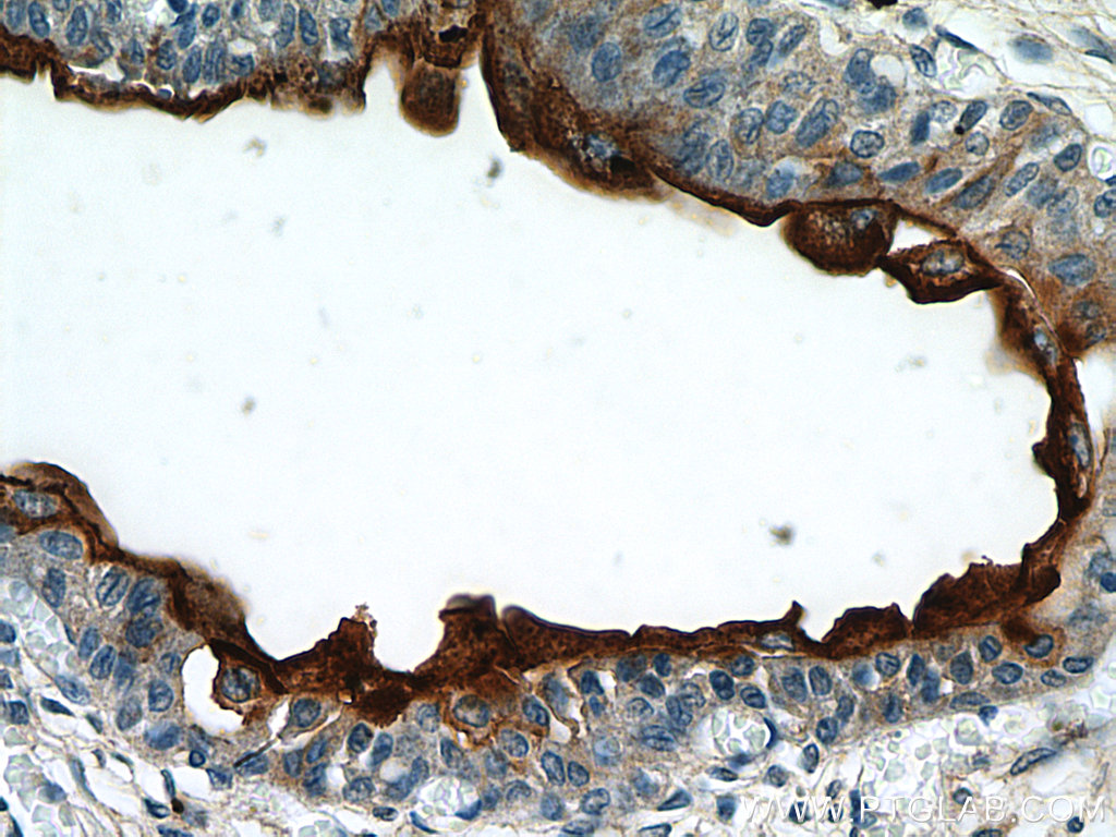 IHC staining of human bladder using 15709-1-AP