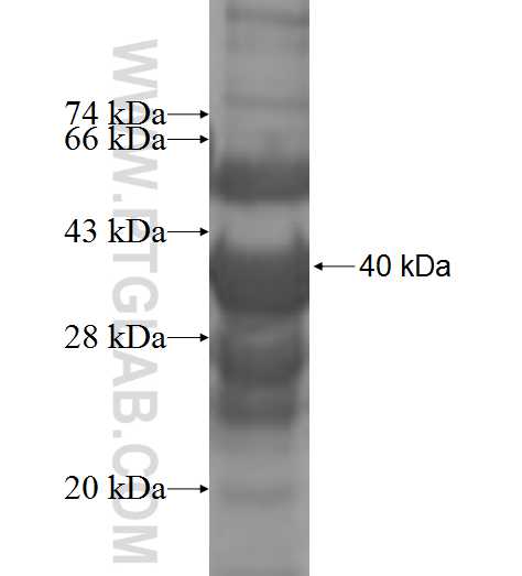 UPK3B fusion protein Ag8428 SDS-PAGE