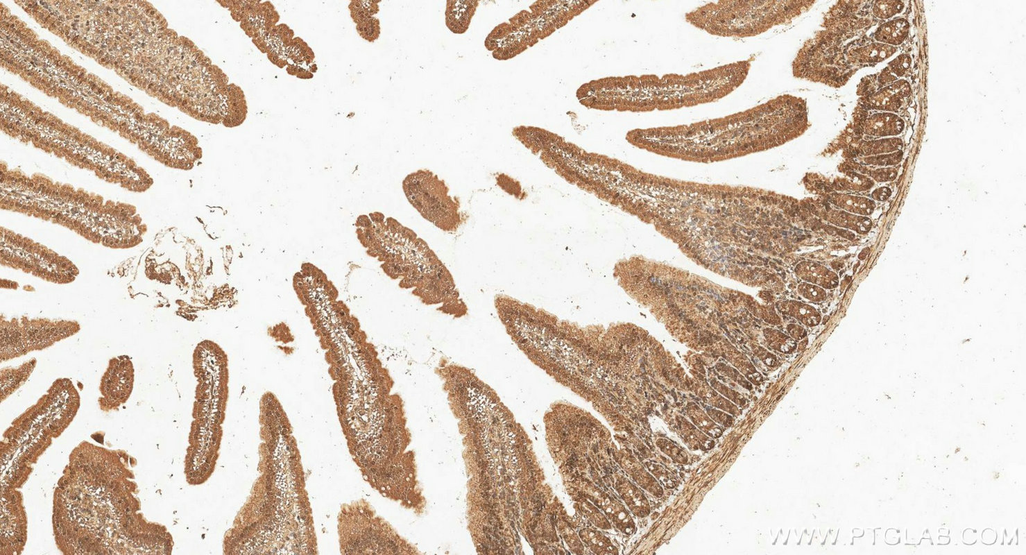 IHC staining of mouse small intestine using 14186-1-AP IHC staining of mouse small intestine using 14186-1-AP