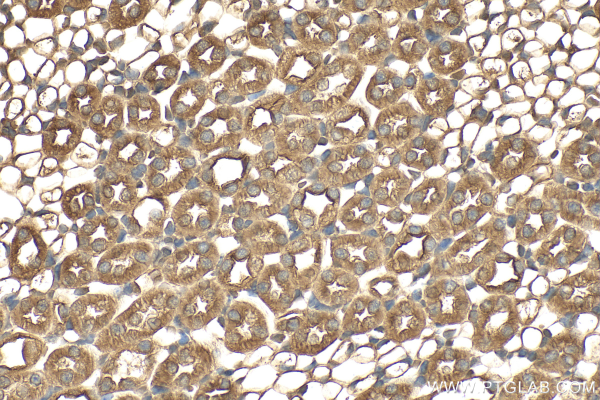 IHC staining of mouse kidney using 12964-1-AP (same clone as 12964-1-PBS)