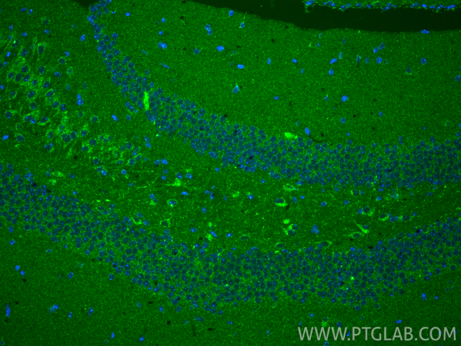 IF Staining of mouse brain using 28114-1-AP