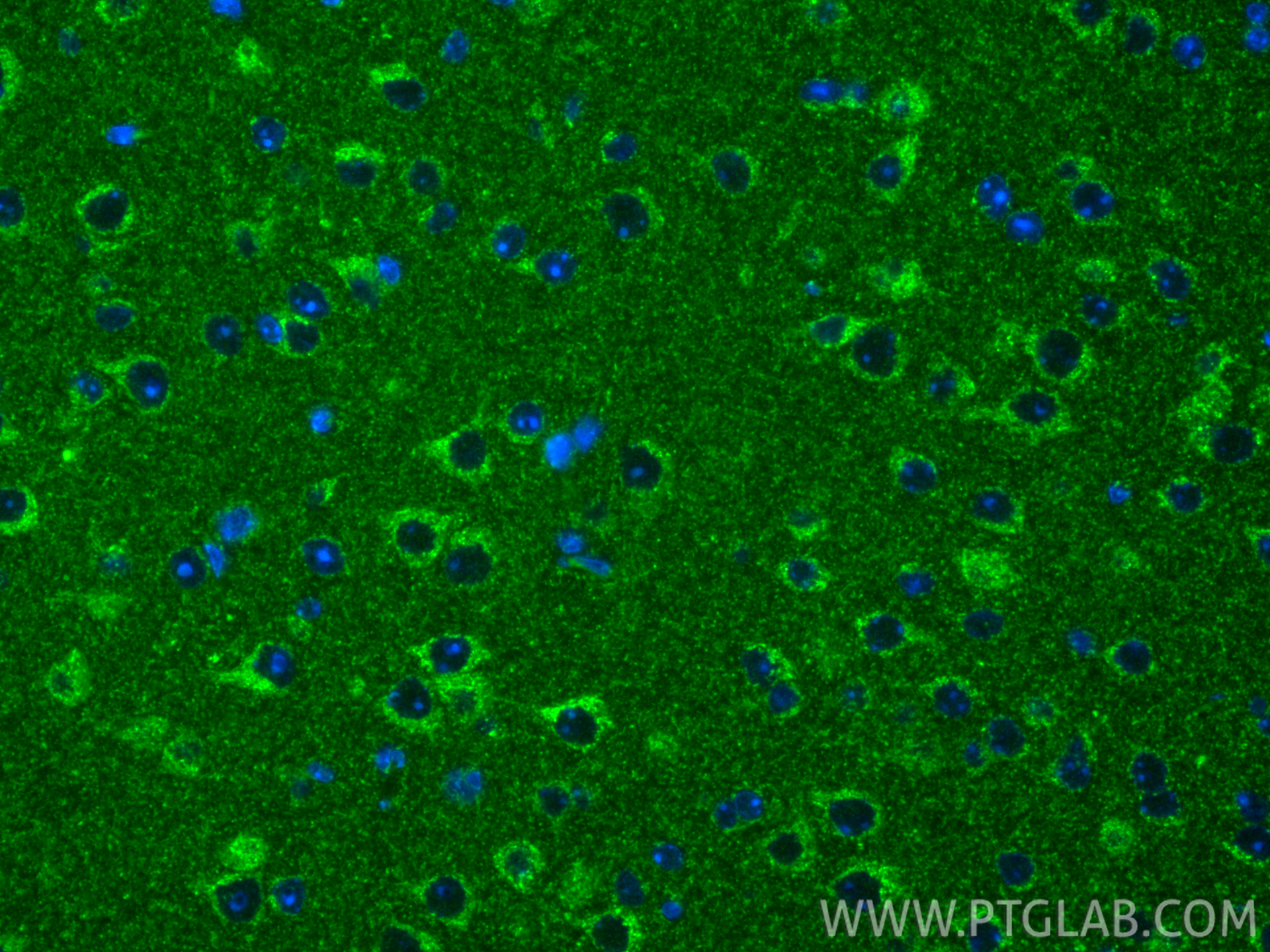 IF Staining of mouse brain using 28114-1-AP